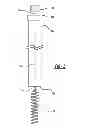 Fig. 04 - Helical fibrin removal tool