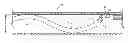 Fig. 01 - Method for manipulating catheter shaft