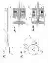 Fig. 02 - Method for manipulating catheter shaft