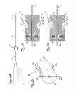Fig. 03 - Method for manipulating catheter shaft