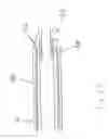 Fig. 22 - Guide-wire dilation device for facilitation of lesion crossing