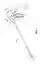 Fig. 02 - Surgical instrument