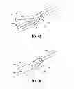 Fig. 03 - Surgical instrument