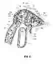 Fig. 07 - Surgical instrument