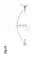 Fig. 09 - Forceps and forceps unit