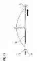 Fig. 11 - Forceps and forceps unit