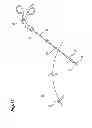 Fig. 13 - Forceps and forceps unit
