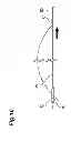Fig. 15 - Forceps and forceps unit