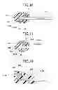 Fig. 09 - METHOD OF TREATING A LUMEN REGION OF A SUBJECT