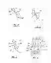 Fig. 03 - Device and method for removing tissue inside a body vessel