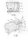 Fig. 05 - Device and method for removing tissue inside a body vessel