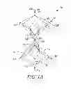 Fig. 02 - INFERIOR VENA CAVA FILTER
