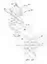 Fig. 09 - INFERIOR VENA CAVA FILTER