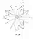 Fig. 14 - INFERIOR VENA CAVA FILTER