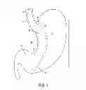 Fig. 02 - GASTRIC TRACTION DEVICE AND METHOD