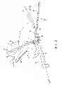 Fig. 04 - GASTRIC TRACTION DEVICE AND METHOD
