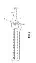 Fig. 05 - GASTRIC TRACTION DEVICE AND METHOD