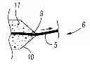 Fig. 01 - ACTIVE LOADED FIXATION DEVICES