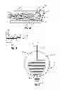 Fig. 02 - ACTIVE LOADED FIXATION DEVICES