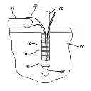 Fig. 01 - Knotless suture anchor