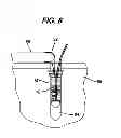 Fig. 08 - Knotless suture anchor