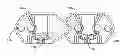 Fig. 01 - Interspinous process spacing device