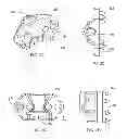 Fig. 03 - Interspinous process spacing device
