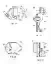 Fig. 05 - Interspinous process spacing device