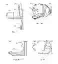 Fig. 06 - Interspinous process spacing device