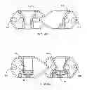 Fig. 08 - Interspinous process spacing device
