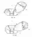 Fig. 09 - Interspinous process spacing device