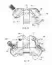 Fig. 12 - Interspinous process spacing device