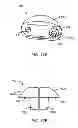 Fig. 23 - Interspinous process spacing device