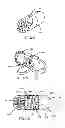 Fig. 24 - Interspinous process spacing device