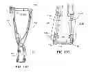 Fig. 28 - Interspinous process spacing device