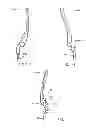 Fig. 29 - Interspinous process spacing device