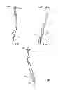 Fig. 30 - Interspinous process spacing device