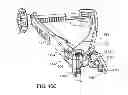 Fig. 33 - Interspinous process spacing device