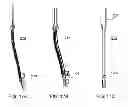 Fig. 34 - Interspinous process spacing device