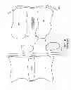Fig. 10 - Dynamized Interspinal Implant