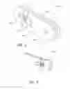 Fig. 04 - Spinous process device and method of use