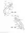 Fig. 23 - Spinous process device and method of use