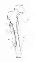 Fig. 02 - Cable plug