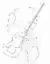Fig. 01 - Bone tamp and methods of use