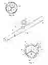 Fig. 04 - Bone tamp and methods of use