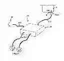 Fig. 01 - AUTOMATED EXTERNAL DEFIBRILLATOR ATTACHMENT FOR ELECTRONIC DEVICE