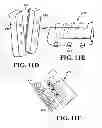 Fig. 16 - AUTOMATED EXTERNAL DEFIBRILLATOR ATTACHMENT FOR ELECTRONIC DEVICE