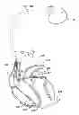 Fig. 01 - SYSTEMS AND METHODS FOR POSTEXTRASYSTOLIC POTENTIATION USING ANODIC AND CATHODIC PULSES GENERATED BY AN IMPLANTABLE MEDICAL DEVICE