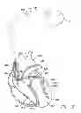 Fig. 16 - Systems and methods for packed pacing using bifurcated pacing pulses of opposing polarity generated by an implantable medical device
