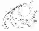 Fig. 01 - Mechanism for detecting coronary ischemia